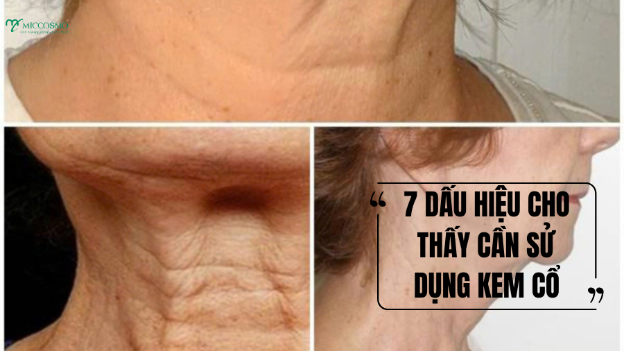 Top 7 dấu hiệu cho thấy bạn cần dùng kem dưỡng cổ sớm